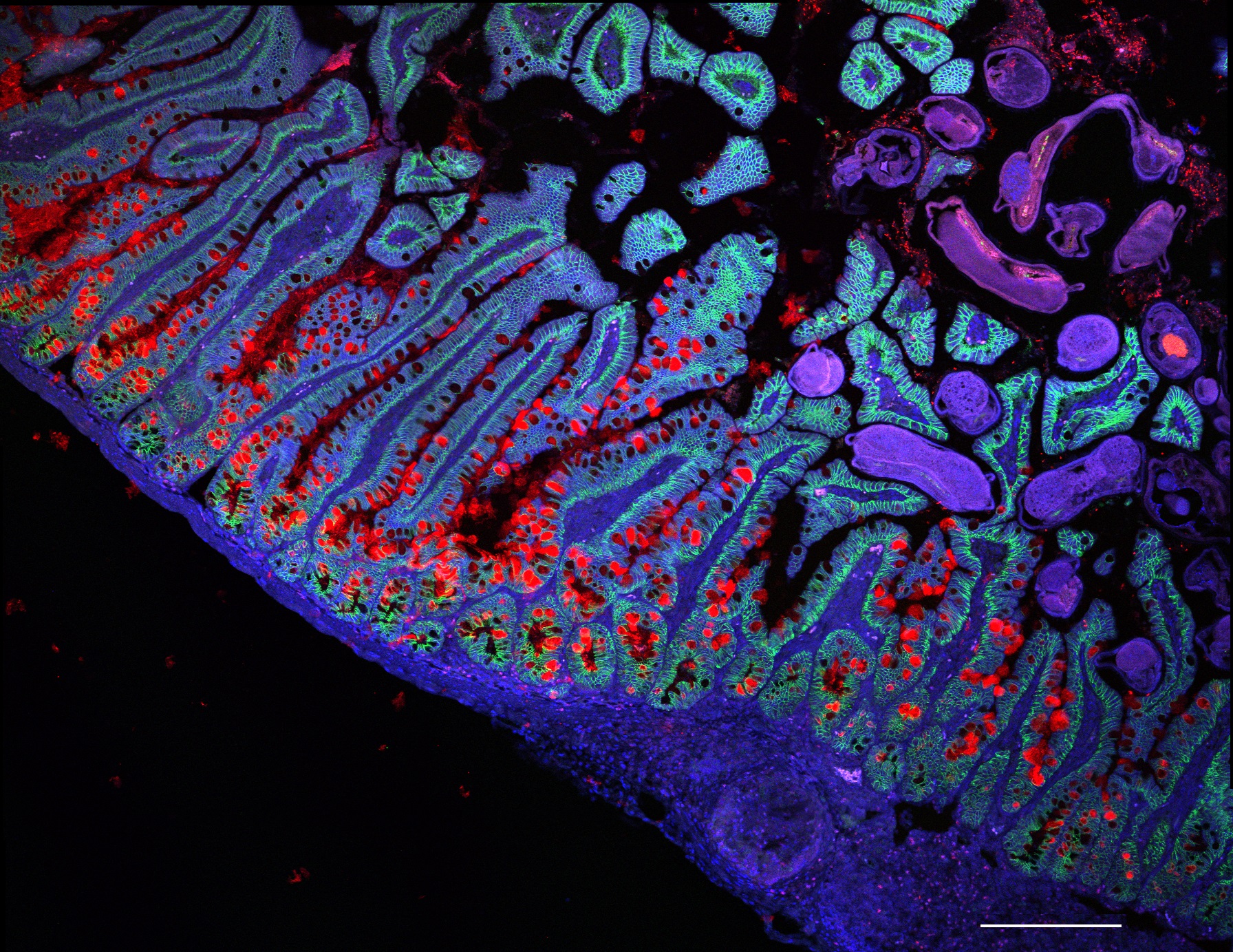 crohns_disease_therapeutics